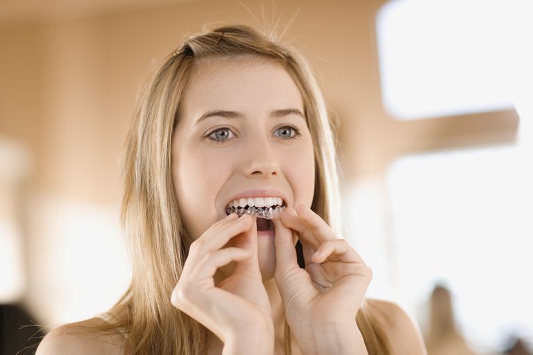 sbiancare denti, livello perossido, maggior parte, problemi sensibilità, sensibilità denti, aiutare ridurre