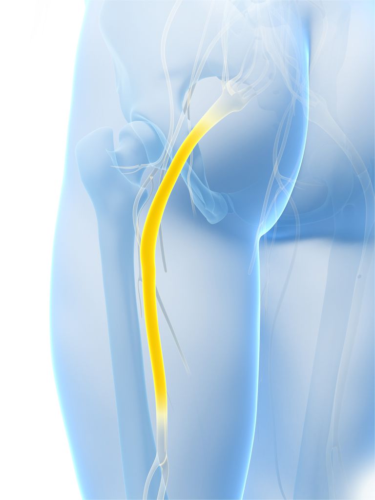 nervo sciatico, della coscia, ernia disco, muscoli posteriori, muscoli posteriori della, posteriori della