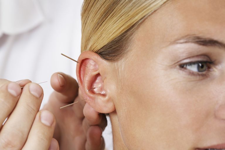 perdita peso, punti agopuntura, agopuntura laser, ricercatori hanno, sull agopuntura, sull orecchio