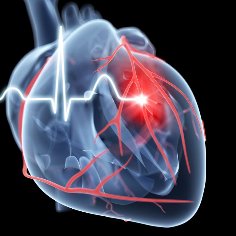 inibitori PCSK9, eventi cardiovascolari, degli studi, lungo termine