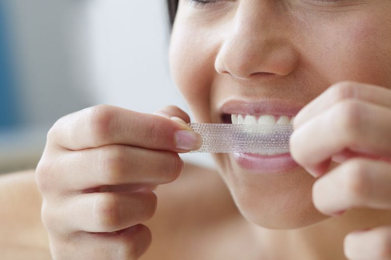 sbiancamento denti, soluzione sbiancante, durante processo, durante processo sbiancamento, effetti collaterali