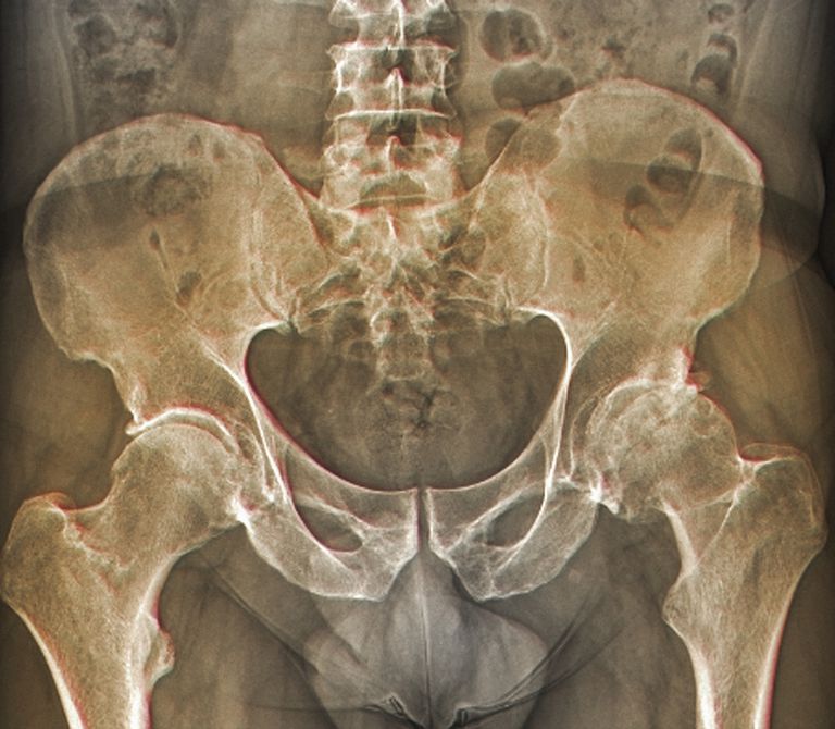 della cartilagine, dell osso, estremità dell, estremità dell osso, contro altra, delle ossa