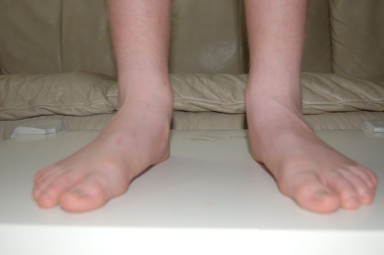 piedi piatti, dolore tallone, parte posteriore, parte posteriore tallone, possono essere