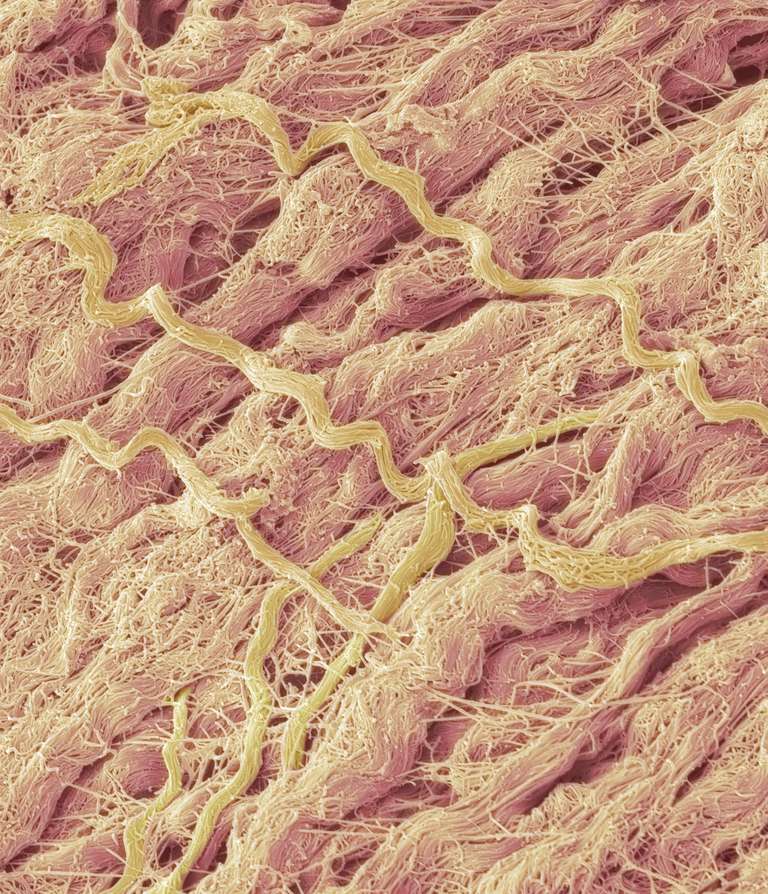 tessuto connettivo, connettivo irregolare, matrice extracellulare, tessuto connettivo irregolare, connettivo supporto, malattie tessuto