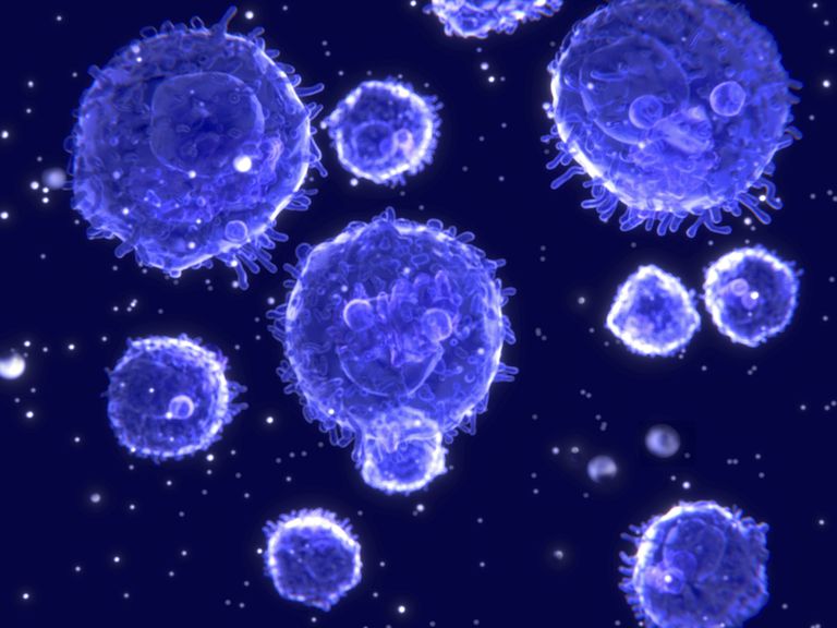 cellule cellule, Linfoma cellule, linfomi cellule, basso grado, come linfoma, comune linfoma