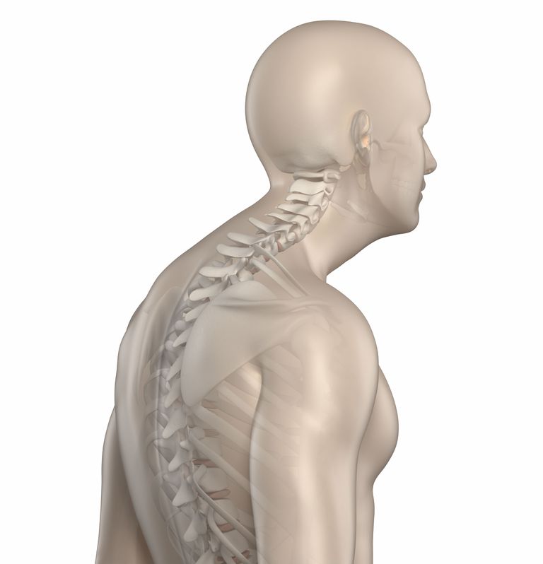 della schiena, cifosi dorsale, colonna vertebrale, nella parte, parte superiore, colonna vertebrale toracica