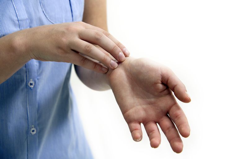 dermatite disidrotica, possono essere, controllare prurito, dermatite atopica, maggior parte, mani piedi