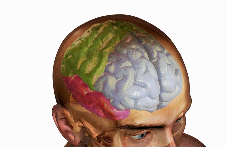 lobo frontale, cervello essere, cranico lobo, cranico lobo frontale, della lesione, lesioni cerebrali