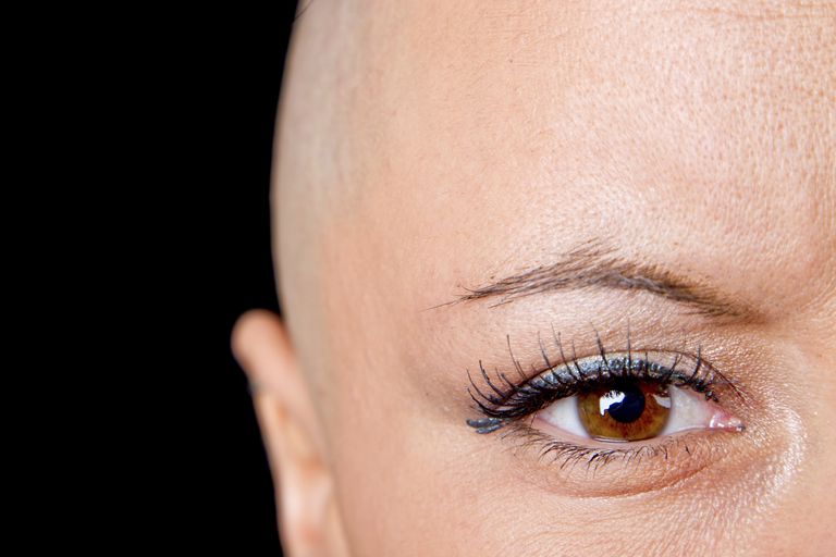 cellule tumorali, capelli dopo, capelli dopo chemioterapia, dopo chemioterapia, tuoi capelli