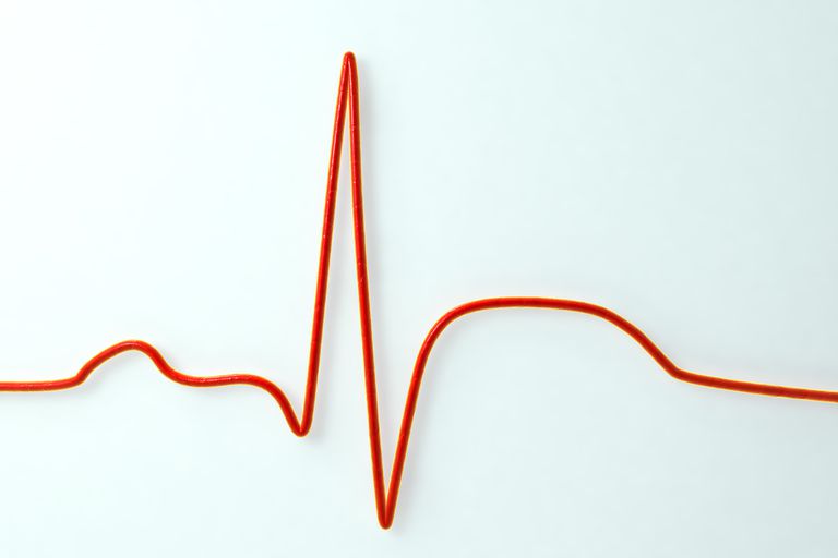 arresto cardiaco, muscolo cardiaco, attacco cuore, della vittima, fibrillazione ventricolare