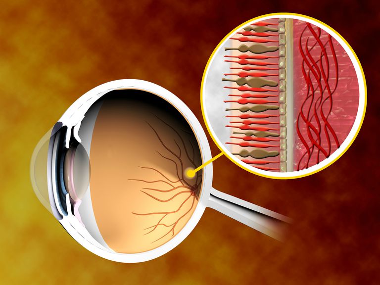 segmento posteriore, dell occhio, della retina, identificate lesioni, nervo ottico