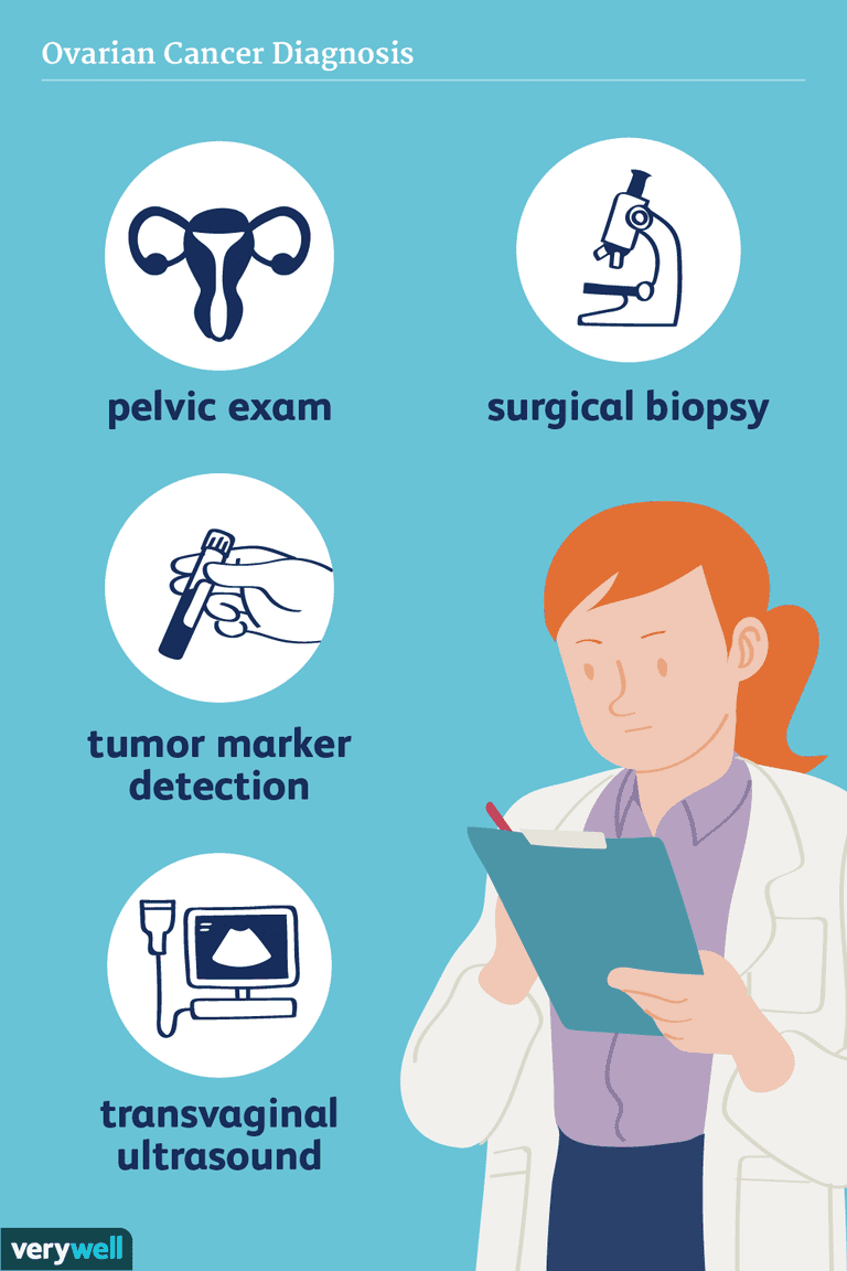 stadio tumore, cancro ovarico, dell ovaio, carcinoma ovarico, possono essere, test imaging