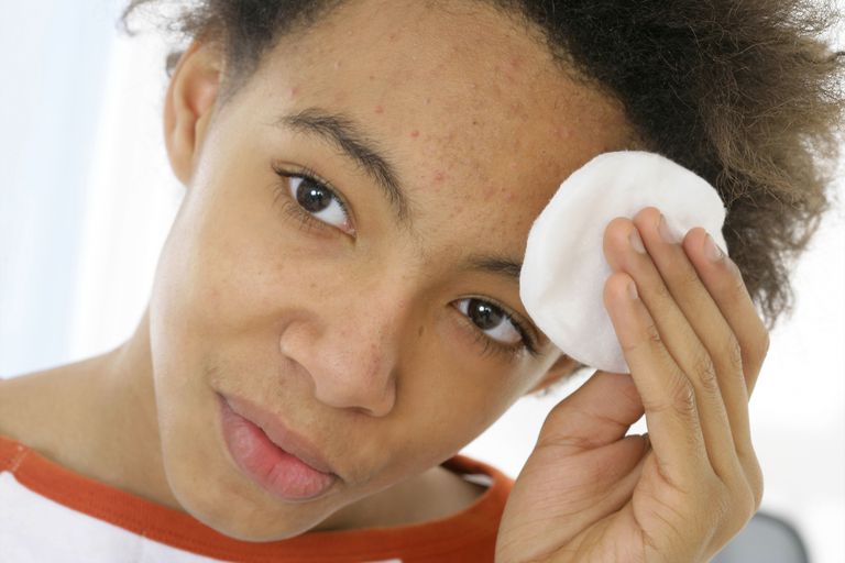 dell acne, durante notte, trattamenti spot, come trattamento, trattamento spot