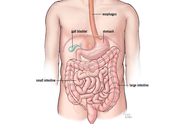 intestino tenue, diagnosi esclusione, intestino crasso, nuovi sintomi