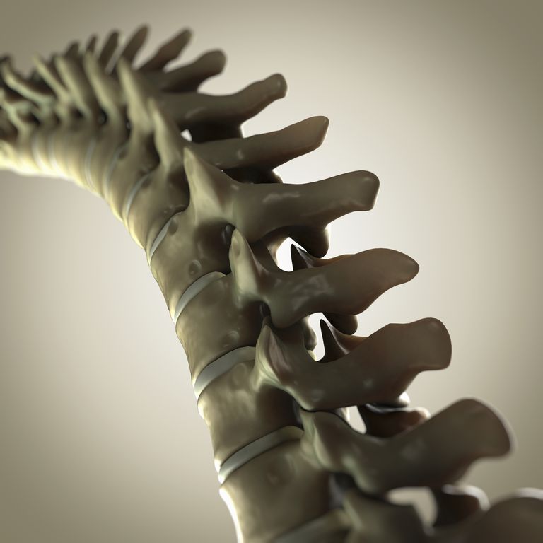 articolazione intervertebrale, colonna vertebrale, chirurgia della, della colonna