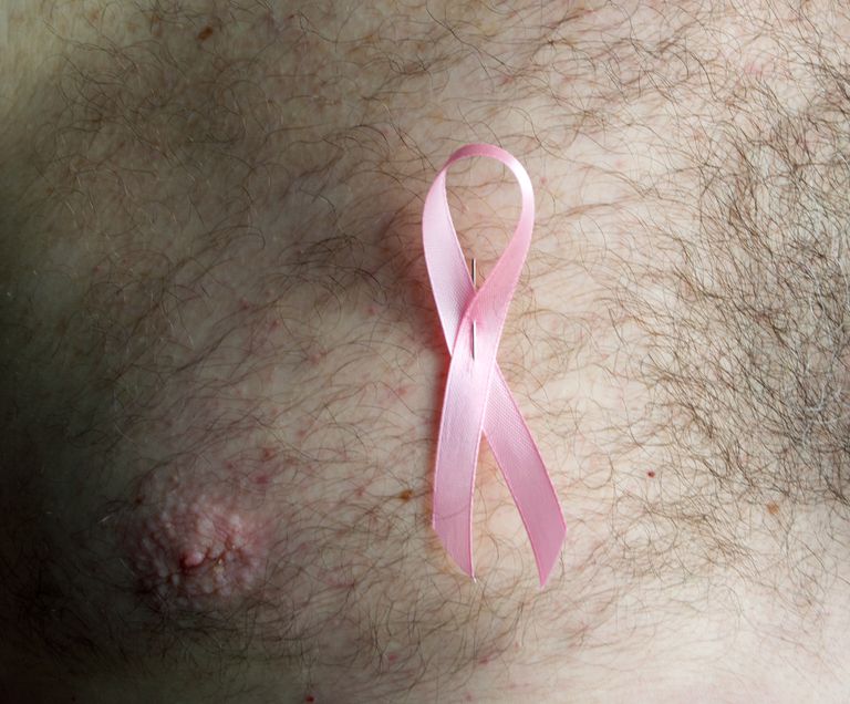 cancro seno, seno maschile, tessuto mammario, cancro seno maschile