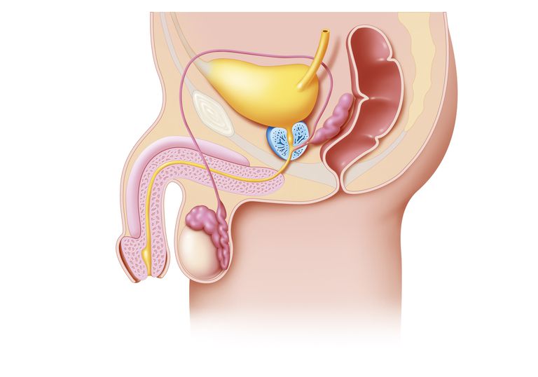 cancro testicoli, tubuli seminiferi, maggior parte, nella vescica, sistema riproduttivo