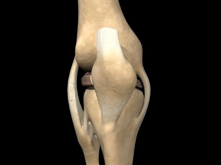 articolazione ginocchio, dell articolazione, dell articolazione ginocchio, collaterale mediale, Lacerazione grado