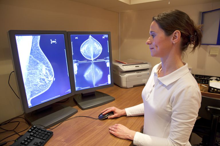 tumore seno, cancro seno, campione tessuto, della mammella, esaminato microscopio, possono aiutare