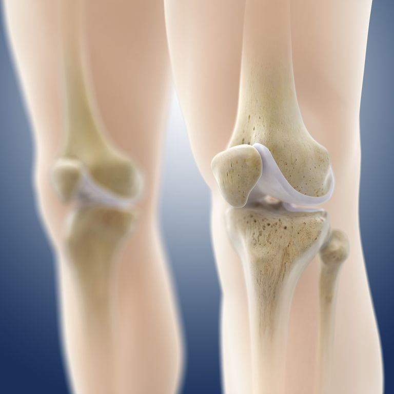 della cartilagine, dell articolazione, delle microfratture, articolazione ginocchio