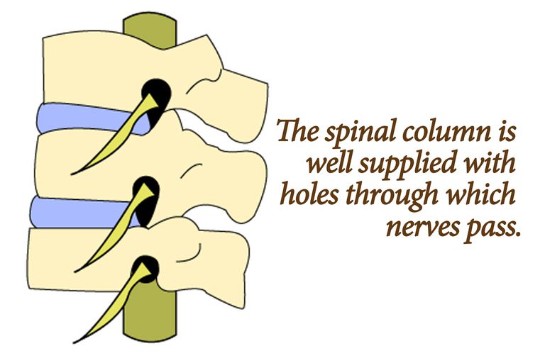 colonna vertebrale, ernia disco, midollo spinale, nervo spinale, radice nervo, radice nervo spinale