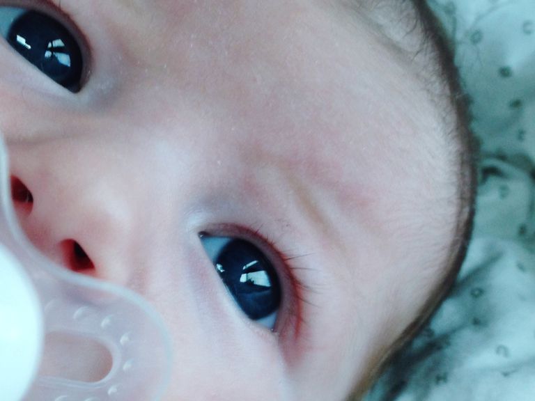 agli occhi, lacrimale ostruito, congiuntivite neonatale, dell occhio, dopo nascita
