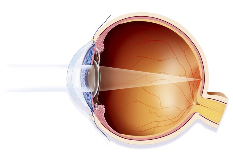 acuità visiva, dell occhio, della cataratta, intervento chirurgico, misuratore acuità, tipica mappa