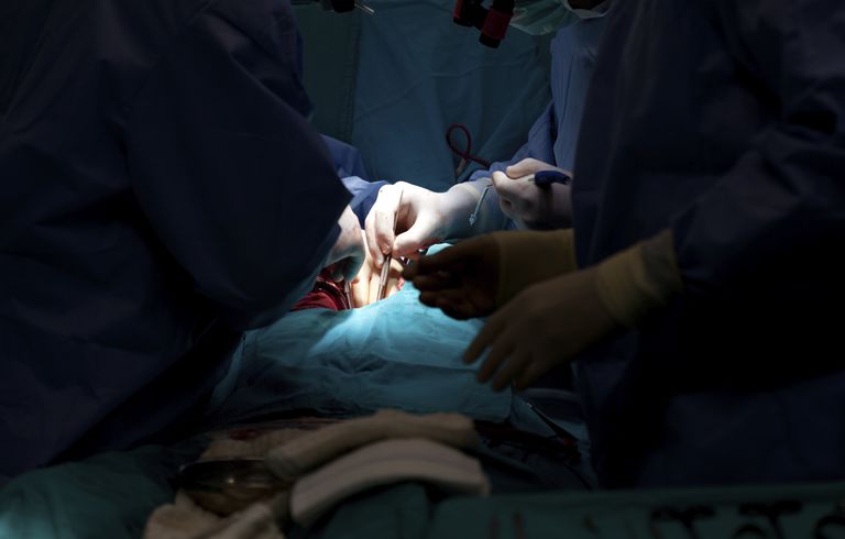 arteria coronaria, chirurgia bypass, intervento chirurgico, dopo intervento