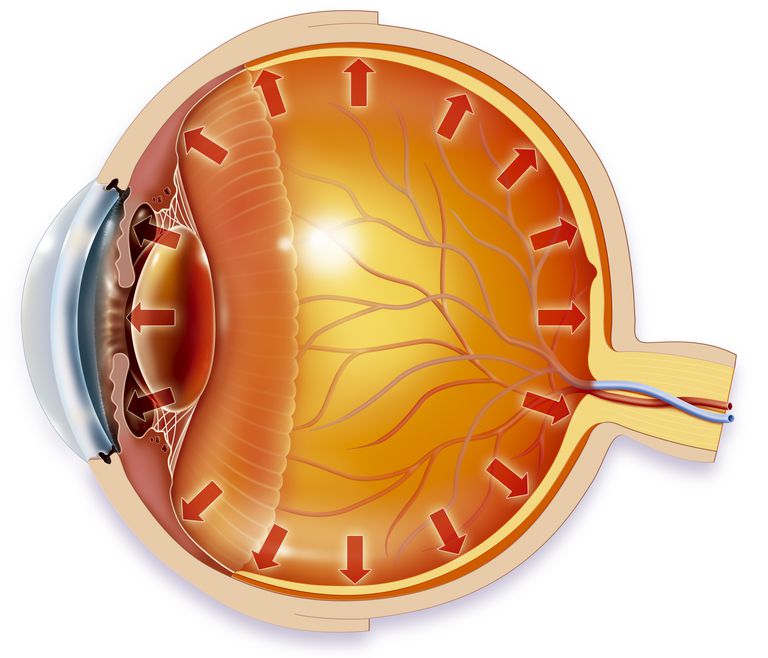 pressione oculare, intervento chirurgico, dopo intervento, canale drenaggio, dopo intervento chirurgico