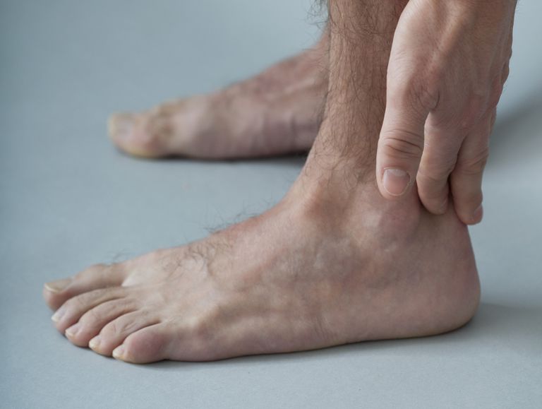 della caviglia, piede della, piede della caviglia, tibiale posteriore, tendinite Achille, tendinite piede