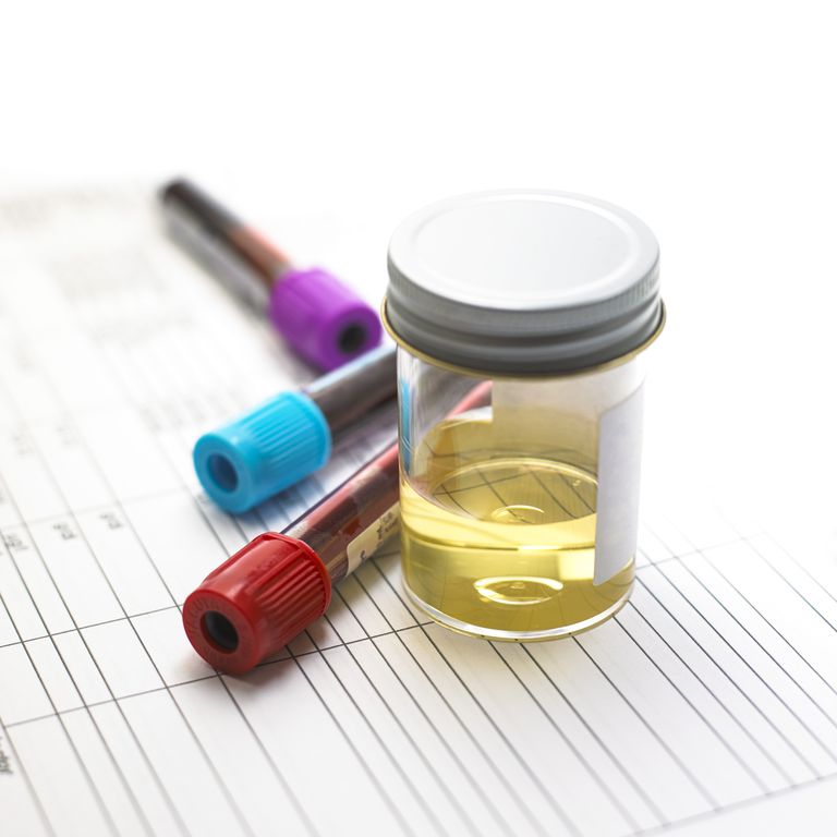 delle urine, test delle, test delle urine, campioni urina