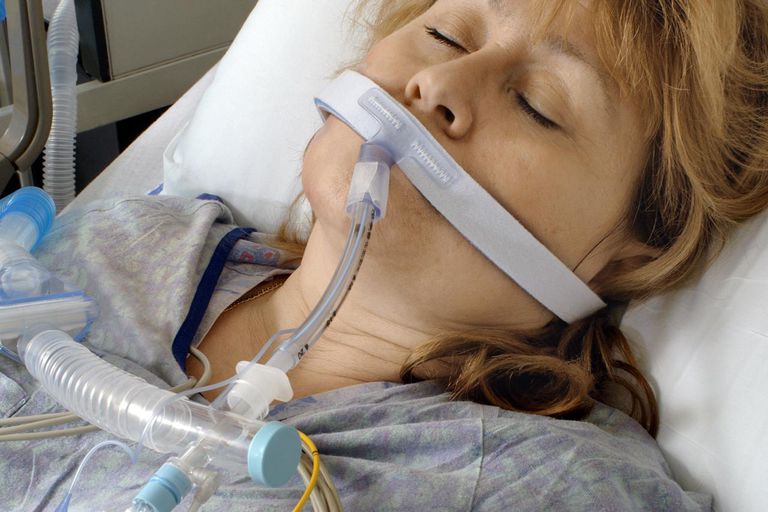 associata ventilatore, polmonite associata ventilatore, prima dell, rischio polmonite, acquisita ventilatore, dell intervento