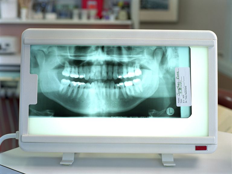 dentista ortodontista, record dentali, sono importanti, trattamento ortodontico