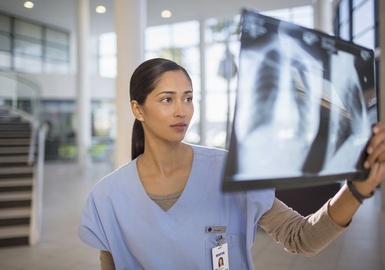ombra polmone, possono essere, test imaging, cancro polmone, cancro polmoni