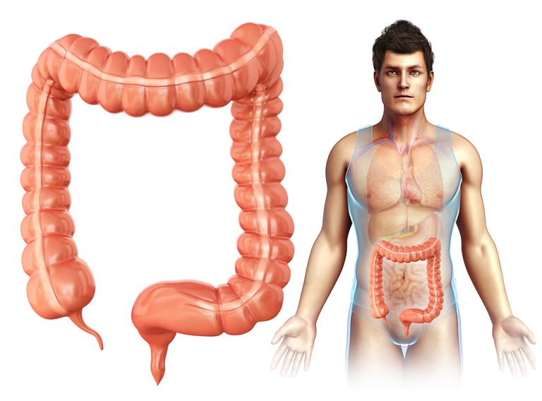 colon trasverso, intestino crasso, tumori colon, circa centimetri