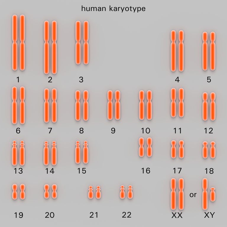 test cariotipo, possono essere, globuli bianchi, anomalie cromosomiche