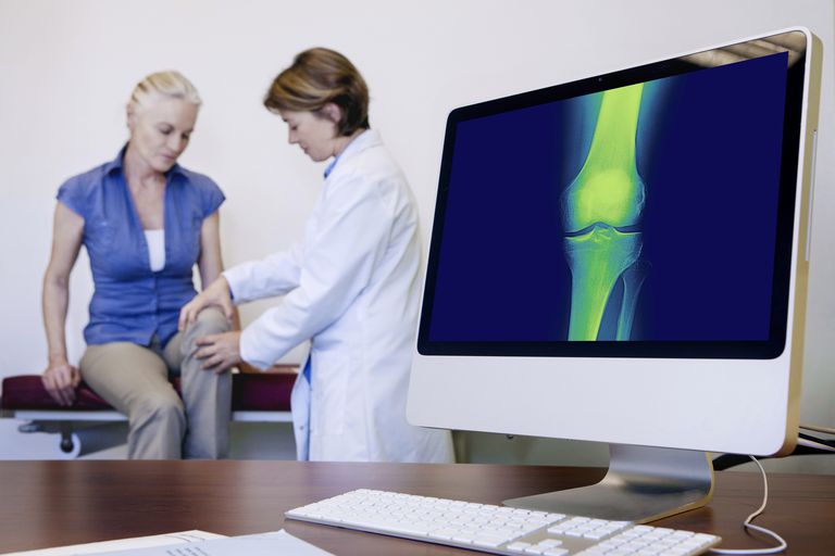 artrosi ginocchio, sostituzione totale, sostituzione totale ginocchio, totale ginocchio, osteoartrosi ginocchio