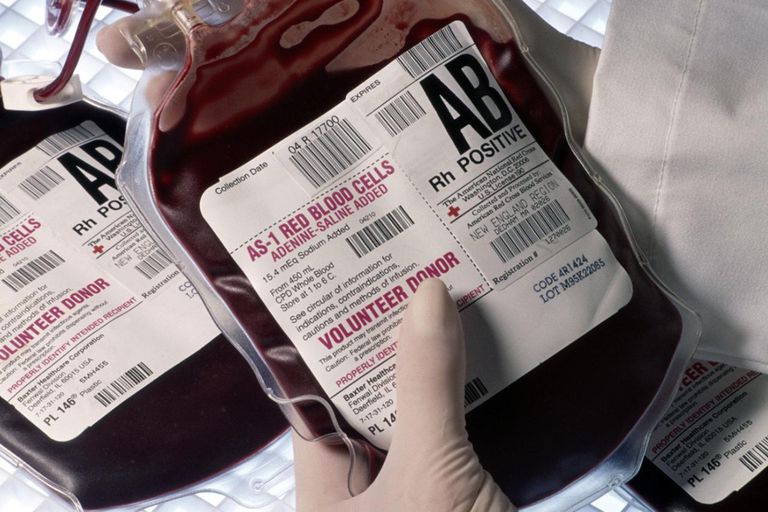 gruppo sanguigno, trasfusione sangue, tipi sangue, destinatario universale