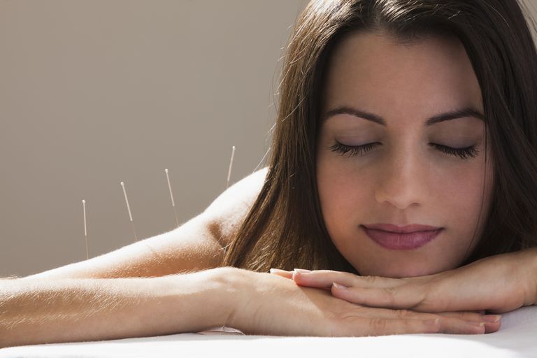 aghi sterili, agopuntura come, come terapia, come terapia complementare, dell agopuntura