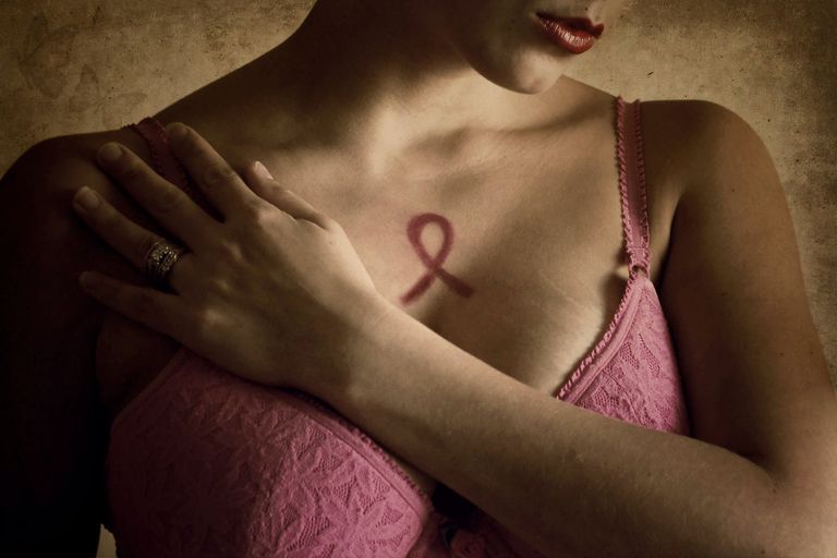 carcinoma mammario, carcinoma mammario metaplastico, mammario metaplastico, cancro seno