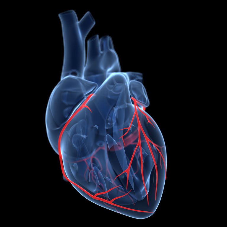 arterie coronarie, muscolo cardiaco, arteria coronaria, attacco cardiaco, dall arteria